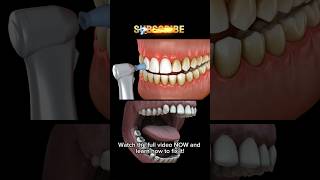 The SHOCKING Truth About Bad Breath and Your Teeth