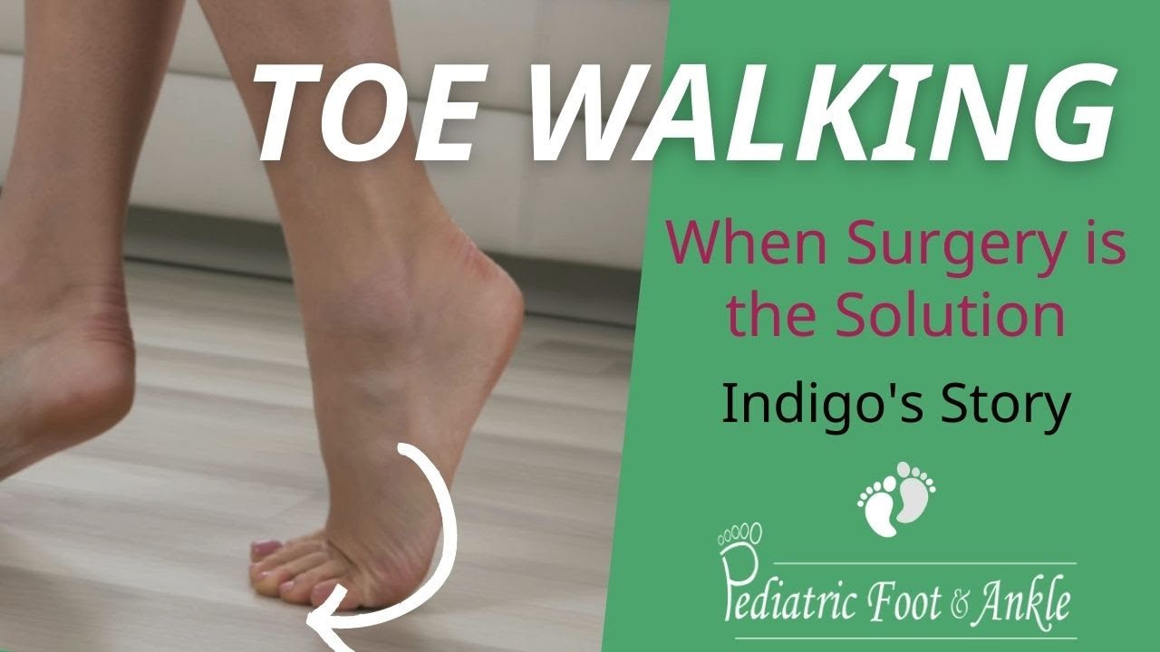 Meet Indigo A Toe Walking Surgery Story YouTube meet-indigo-a-toe-walking-surgery-story-youtube