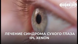 Лечение синдрома сухого глаза с революционной технологией IPL xenon