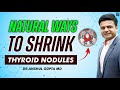 Thyroid nodules  causes and natural ways to shrink thyroid nodules 