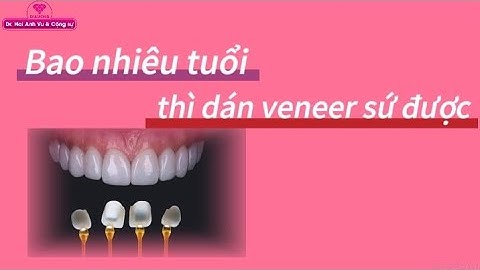 Độ tuổi dán veneer sứ | Tt niềng răng quốc tế Diamond