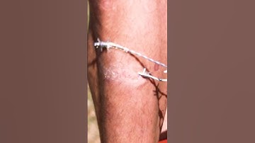 Barbed Wire Weed Wacker VS My Shin! #funny #memes #science