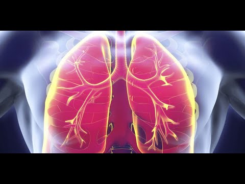 SEMIOLOGÍA De la Neumonía y Derrame Pleural.