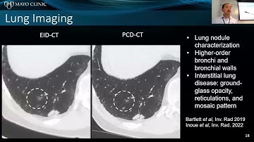 (Invited Talk) Photon counting detector computed tomography: clinical applications