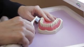 Reducing Plaque Buildup in Teeth : Caring for Your Teeth