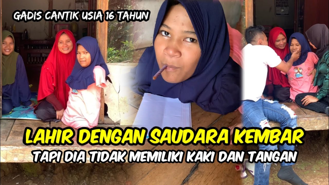 KEMBAR TAPI TAK SAMA,KISAH LISVA GADIS 16 TAHUN TERLAHIR TIDAK MEMELIKI KAKI DAN TANGAN