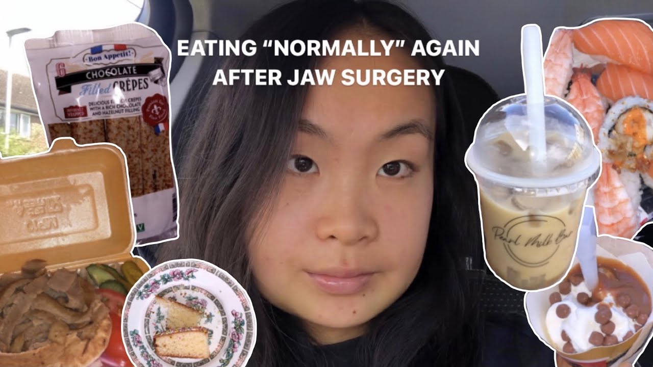 Eating Properly Again After Jaw Surgery WEEK 4 YouTube Eating Properly Again After Jaw Surgery WEEK 4 YouTube