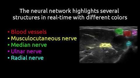 Highlighting nerves and blood vessels for ultrasound axillary nerve blocks using neural networks