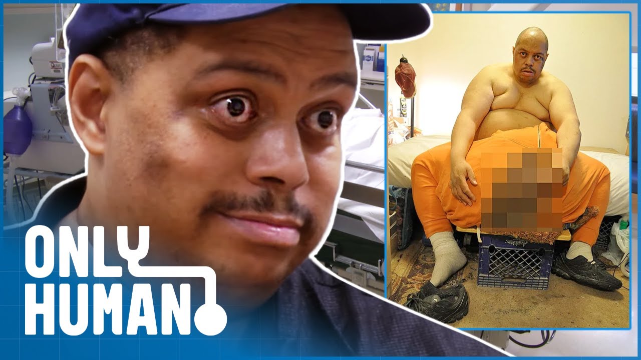 Living With The World's Largest Testicles Is Killing Me (Extreme Medical Conditions) | Only Human