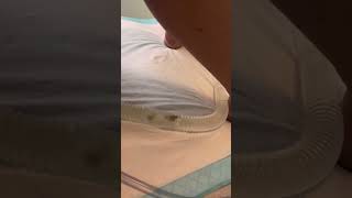 #poonami incoming A great video of super releases during this client’s #colonic #detox Before we tr