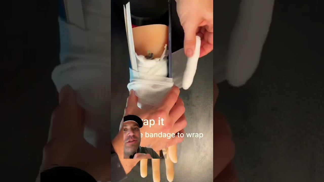 Broken bones, what to do and what not to do. 