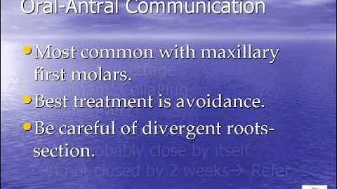 Management of a Small Oral-Antral Opening During Extraction