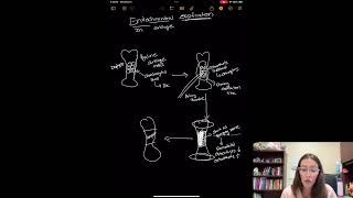 Endochondral Ossification Steps