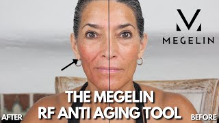 The Megelin RF Anti Aging Tool: A Master Esthetician's Review