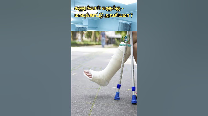 கணுக்கால் சுளுக்கு - மாவுக்கட்டு அவசியமா | Plaster in Ankle sprain| Ankle sprain treatment in tamil