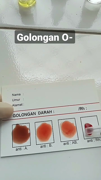 Golongan darah O-