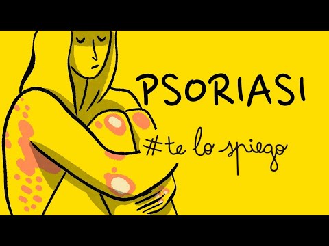 Video: 3 modi per affrontare la psoriasi al lavoro