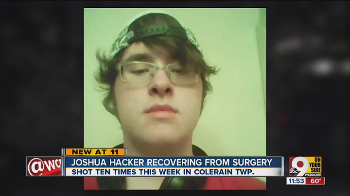 Joshua Hacker recovering from surgery
