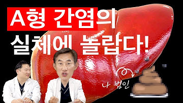 위생만이 답이 아니다?! A형 간염의 진실!