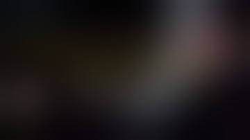 Double Medical Group Calcaneal Fracture MIS Technique-Dr. Michael John Galvin