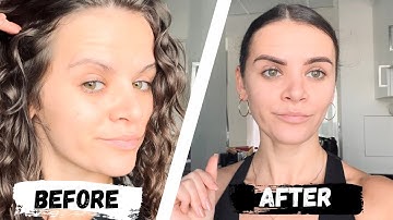 MICROSHADING | 14 DAYS HEALING UPDATE | REVIEW