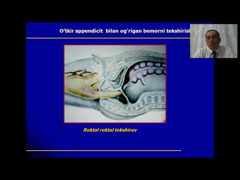 Video: Qaysi HPV siğillarni keltirib chiqaradi?