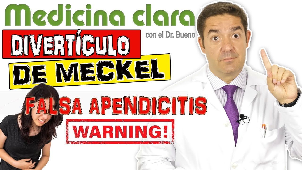 DIVERTÍCULOS DE MECKEL Vs APENDICITIS en JÓVENES  | Medicina Clara