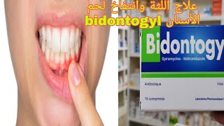 علاج انتفاخ اللثة ولحم الأسنان بدواء bidontogyl