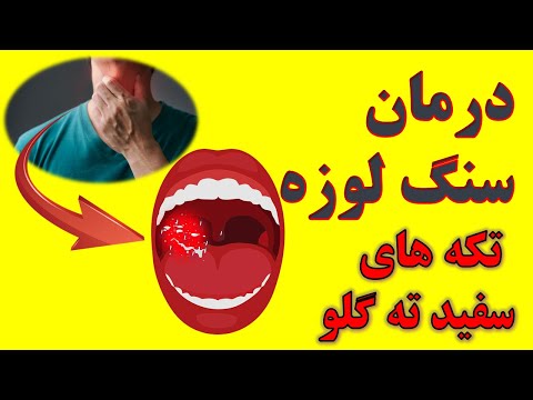 تصویری: 7 روش برای اندازه گیری سطح انسولین در خانه