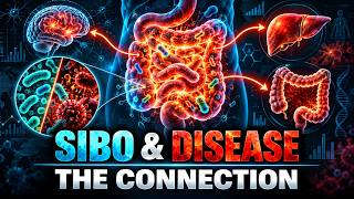 SIBO, Dysbiosis & Disease: The Microbiome Connection