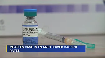 Local health experts encourage measles vaccination as state reports first case in years thumbnail