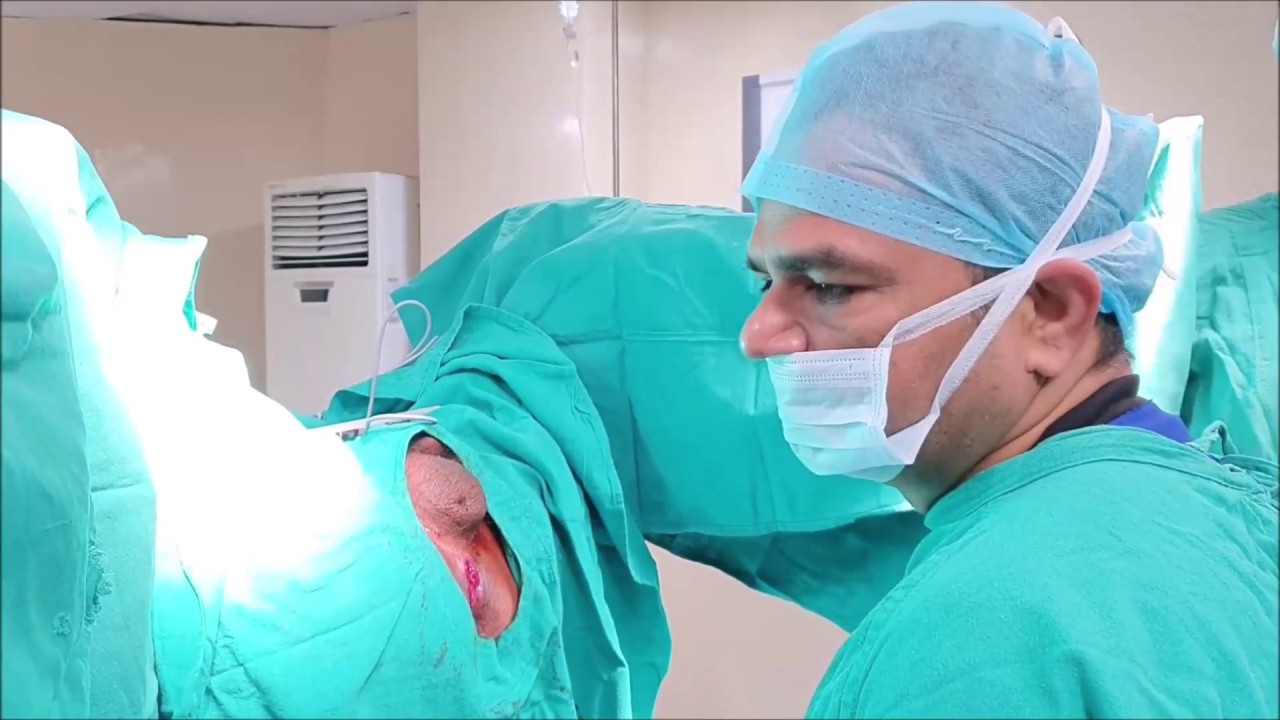 fistula-treatment-by-dr-ashish-bhanot-youtube