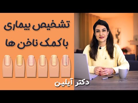 تصویری: بیماری ناخن چیست؟