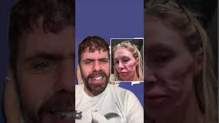 Brandi Glanville Shares Health And Financial Struggles! May Be Homeless Soon! Has Lost 5 Teeth And:
