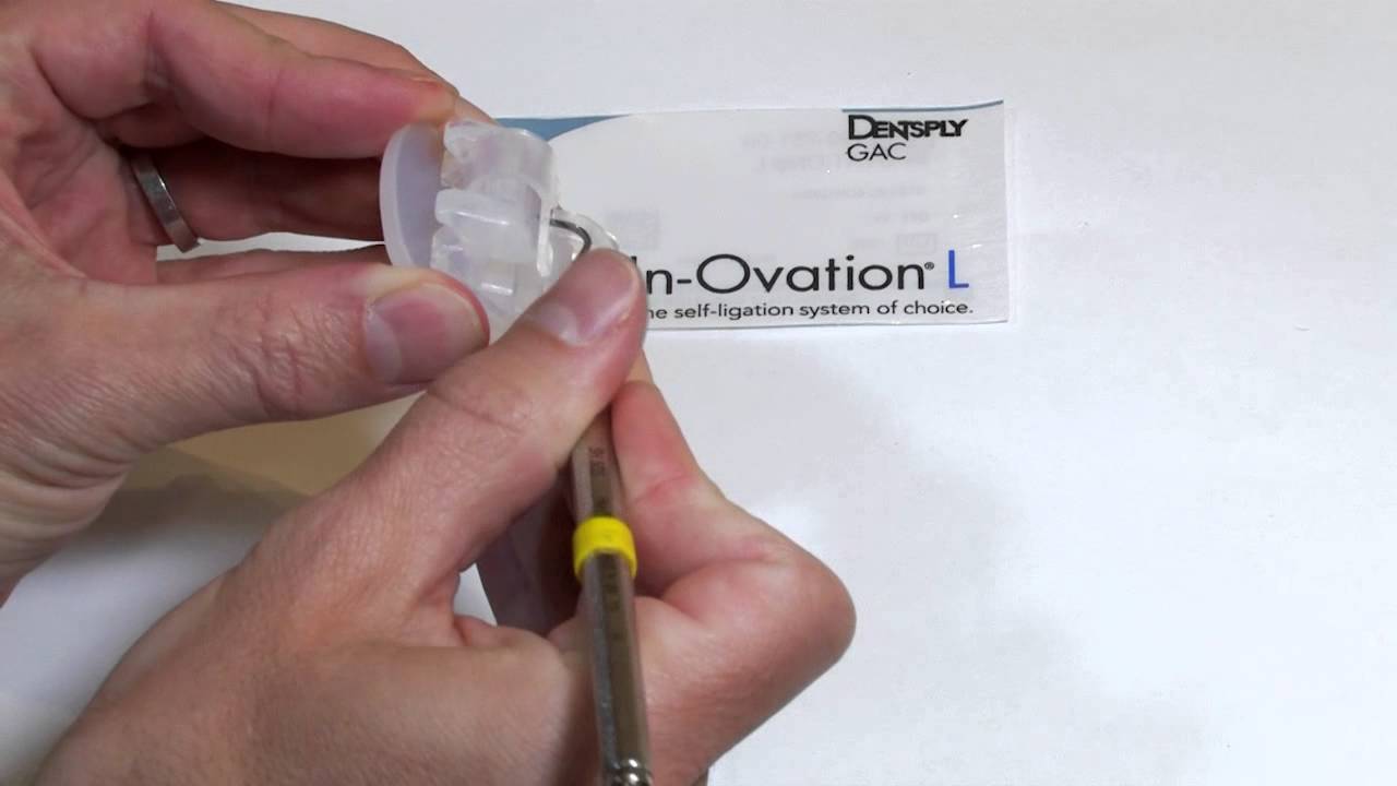 Opening and closing the In-Ovation® L bracket using a basic scaler