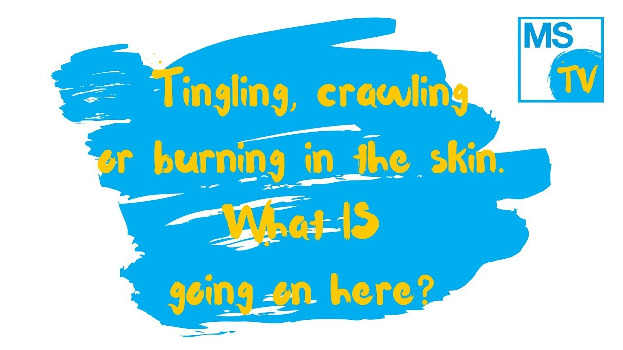 Altered Sensations Tingling Crawling Or Burning In The Skin YouTube Altered Sensations Tingling Crawling Or Burning In The Skin YouTube