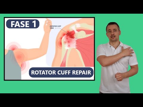 Rotator Cuff Oefeningen | Operatie Revalidatie na Scheur (Repair) - Fase 1 (week 2-6)