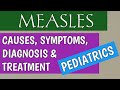 Measles In Children | Subacute Sclerosing Panencephalitis
