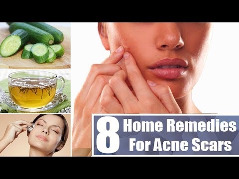  Most Effective Ways To Remove Acne Scars & Pimple Marks | Deep Scars & Pimple Marks  Removal |