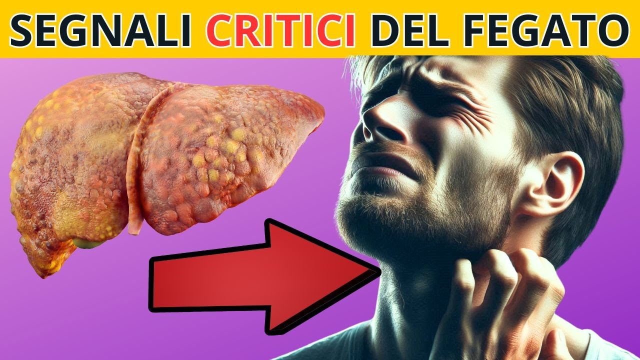 MOLTO PERICOLOSO! Segnali che il tuo FEGATO stà MORENDO ! - YouTube