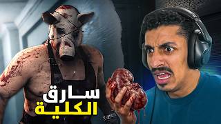 ليش ذا سرق كليتي ؟!