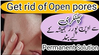 How to get rid of open pores | پھٹکری سے اوپن پورز کا خاتمہ | permanent solution for pores |solution