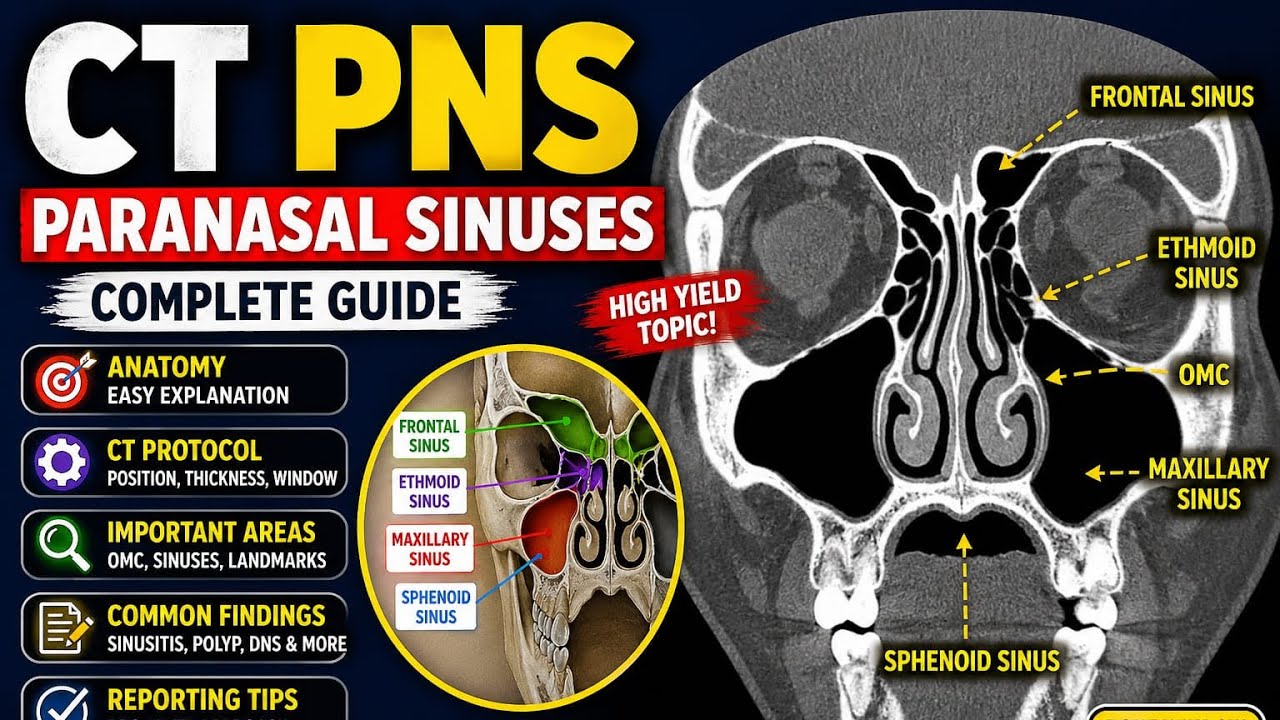 CT PNS With Filming Step-By-Step - YouTube