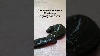 Гирудотерапия избавляет от многих болезней и хорошое действовать для профилактики организма.
