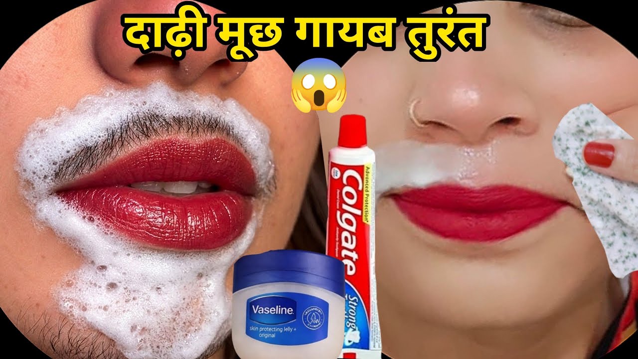 डॉक्टर ने बताया Vaseline से बिना दर्द चेहरे के बाल निकालने का आसान तरीका😱|| Facial Hair Removal