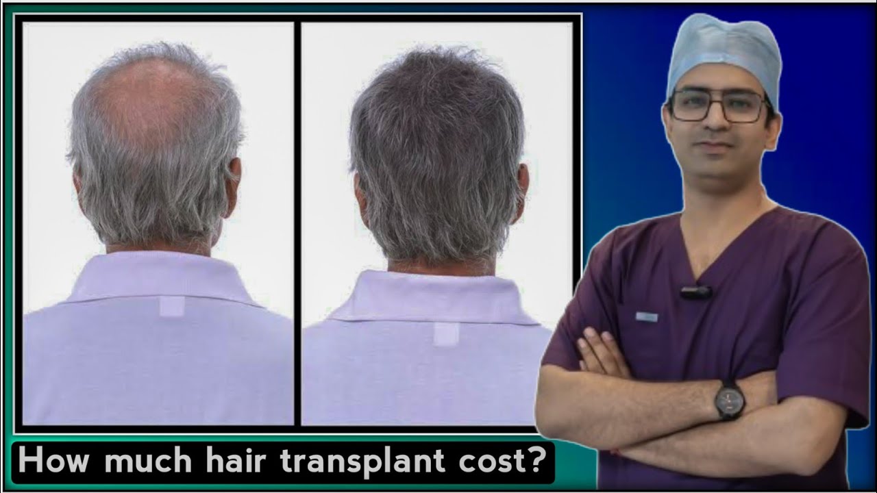 Hair Loss Prevention