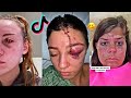 Hey Yo Something Traumatic Happened That Changed My Life Check *Part 5* | TikTok Compilation