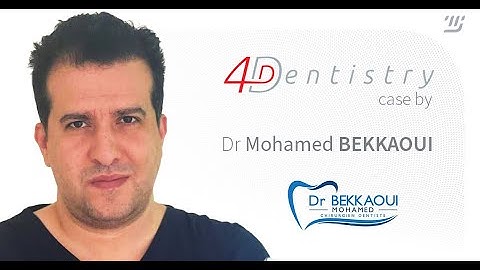 4D Dentistry case by Dr Mohamed Bekkaoui