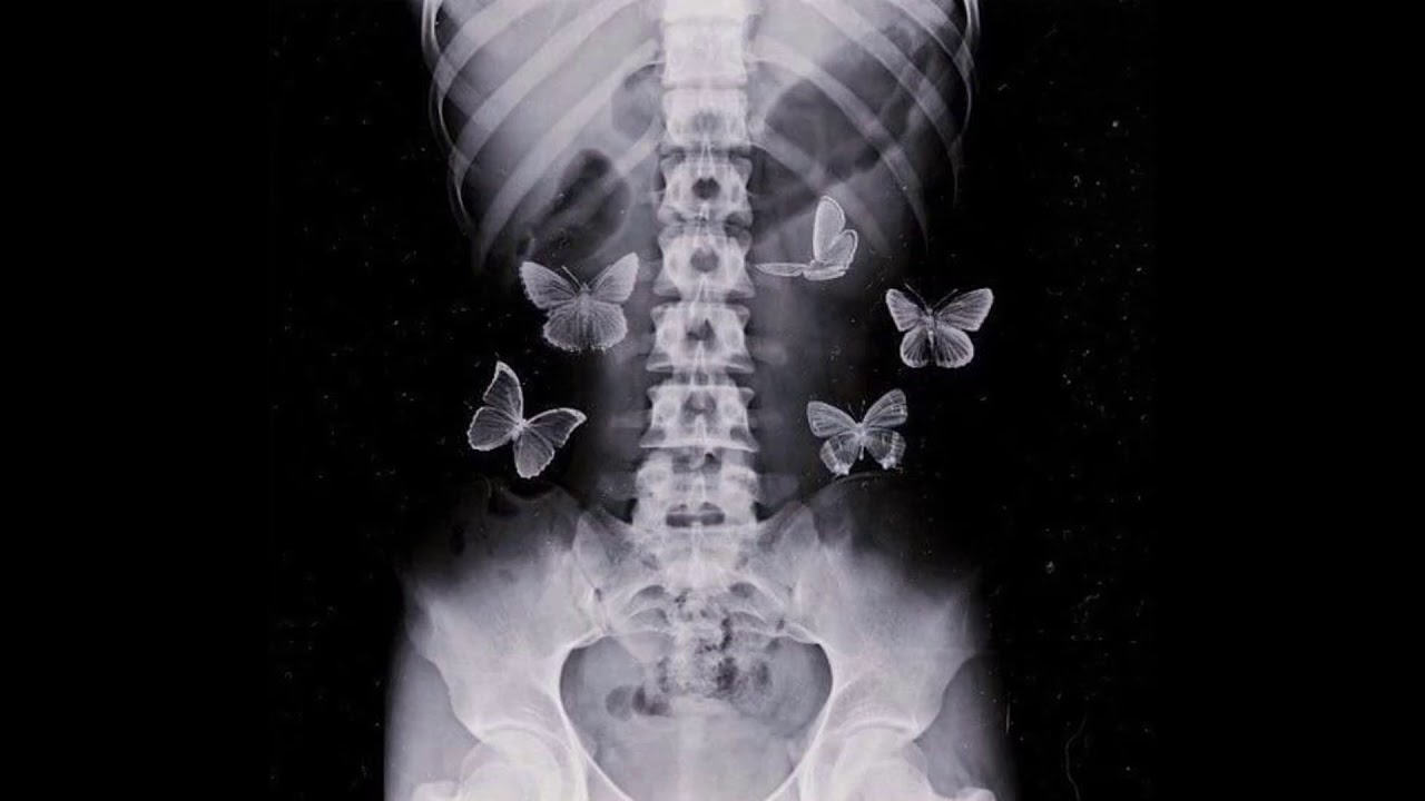 [FREE] killval x juice wrld type beat - "inconsiderate" | prod. june x prod. 05