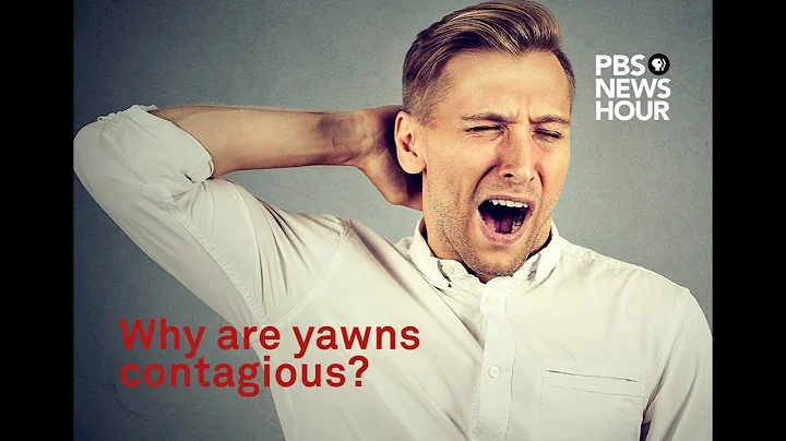 Why are yawns contagious? We asked a scientist